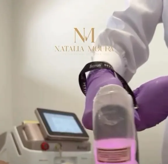 Depilação a laser